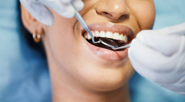 Best Walk-In Emergency Dentist in Centralia, MO